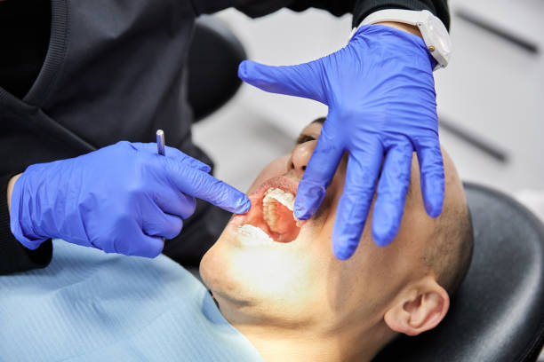 Best Emergency Tooth Extraction in Dock Junction, GA